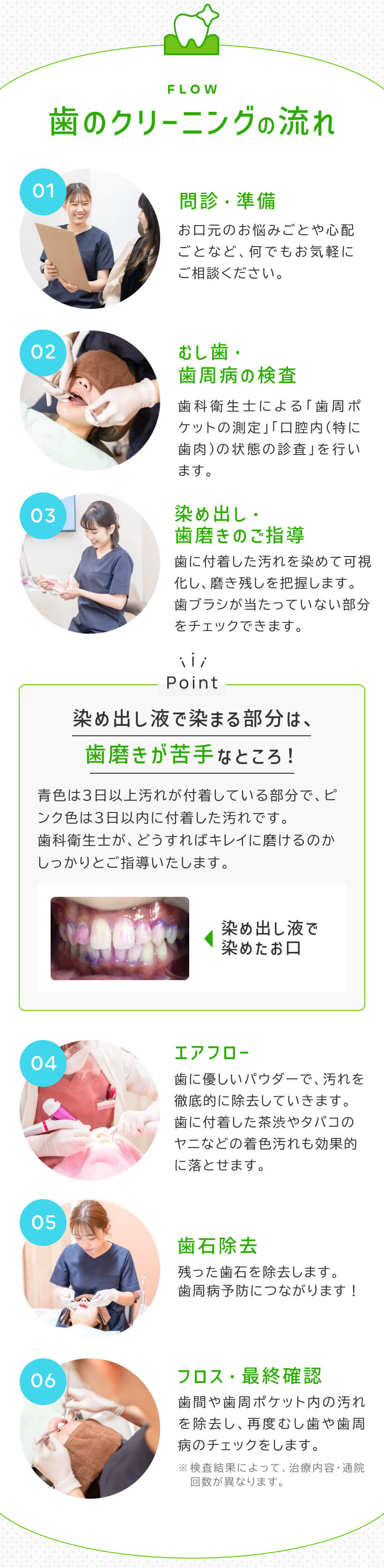 歯のクリーニングの流れ